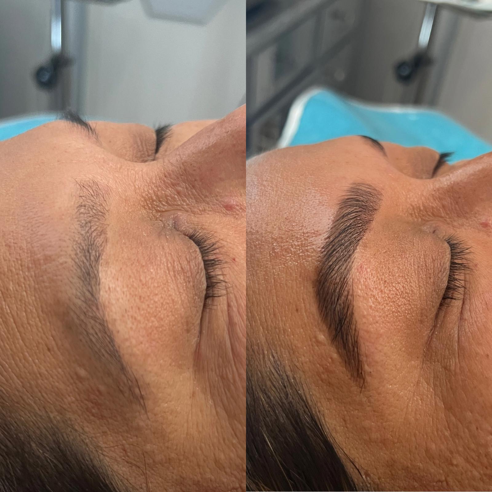 Brow Lamination